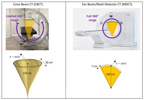 ct vs cbct|cone beam ct scanners comparisons.